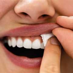 Gum Recession From Nicotine Pouches (Zyns Explained) -