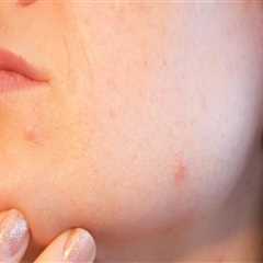 Enhance Your Fitness Routine with Body Contouring in Florida