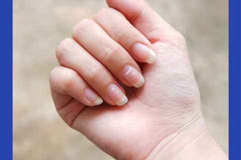 Clinically Speaking: Questions and Answers About Graves’ disease